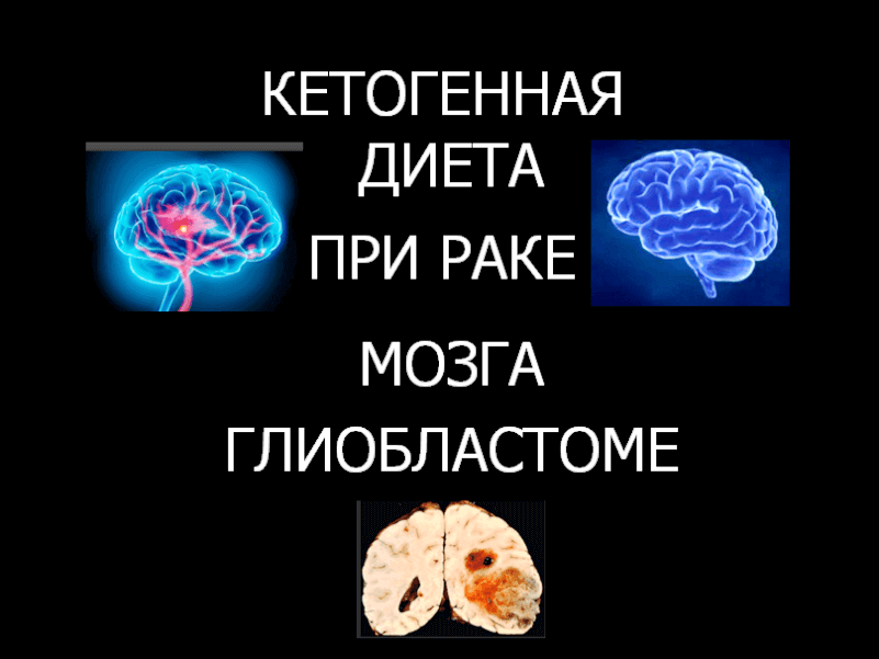 Диета При Раке Мозга