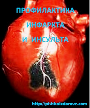 Профилактика инфаркта и инсульта
