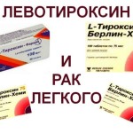 Левотироксин-и-рак-легкого