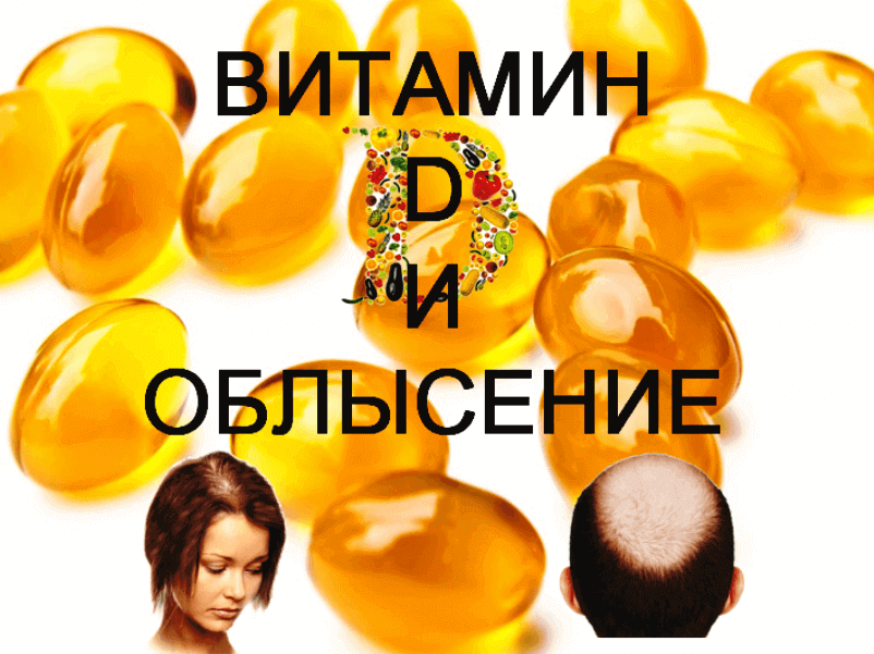 Vitamin-D-and-baldness